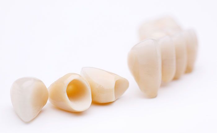 審美・セラミックによる治療